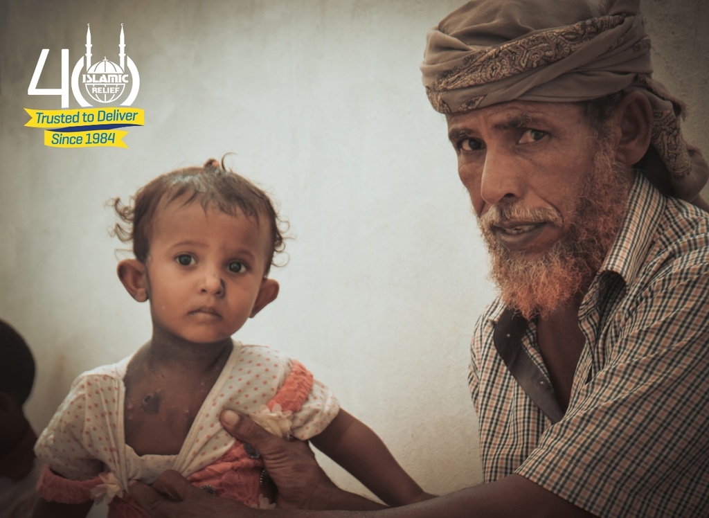 Alleviate Hunger and Empower Hope in Yemen